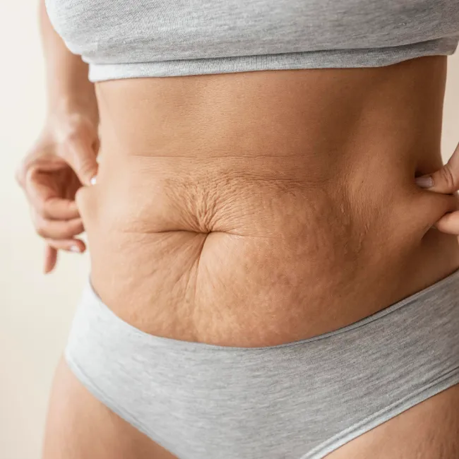 Quali Sono i Candidati Ideali?