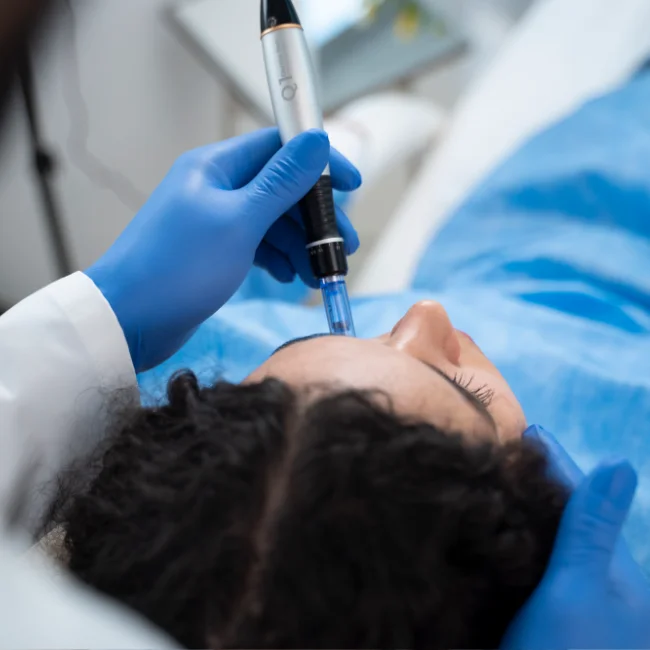 Trapianto di Capelli con Metodo DHI