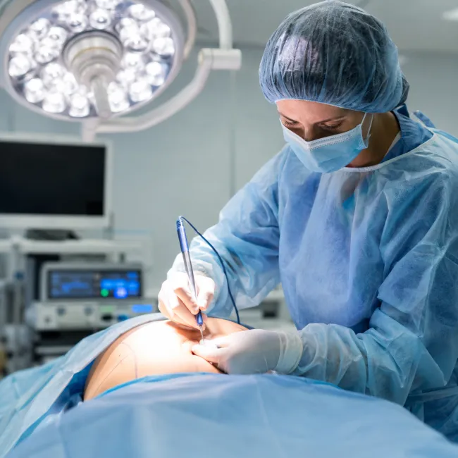 Tummy tuck 2026: complete abdominal reshaping